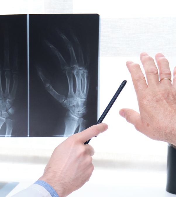 doctor checking x-ray of man with osteoarthritis