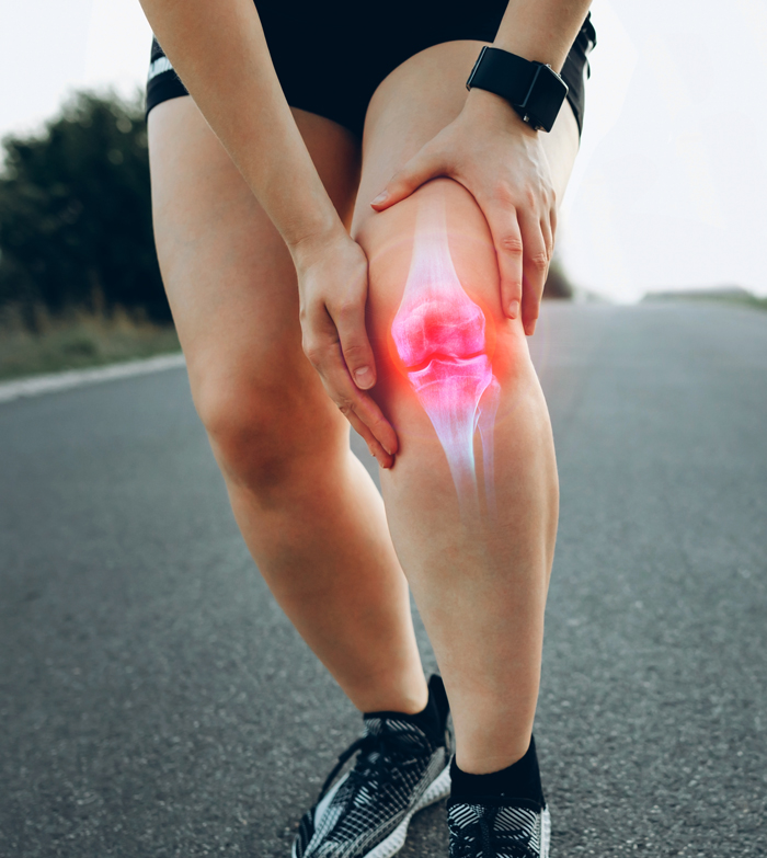 woman with knee pain holding her knee
