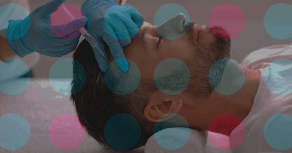 hair restoration with stem cell injection